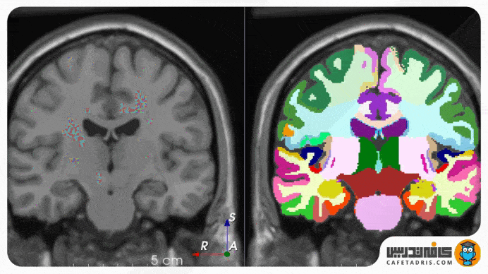شناسایی تصاویر پزشکی (Medical Image Recognition